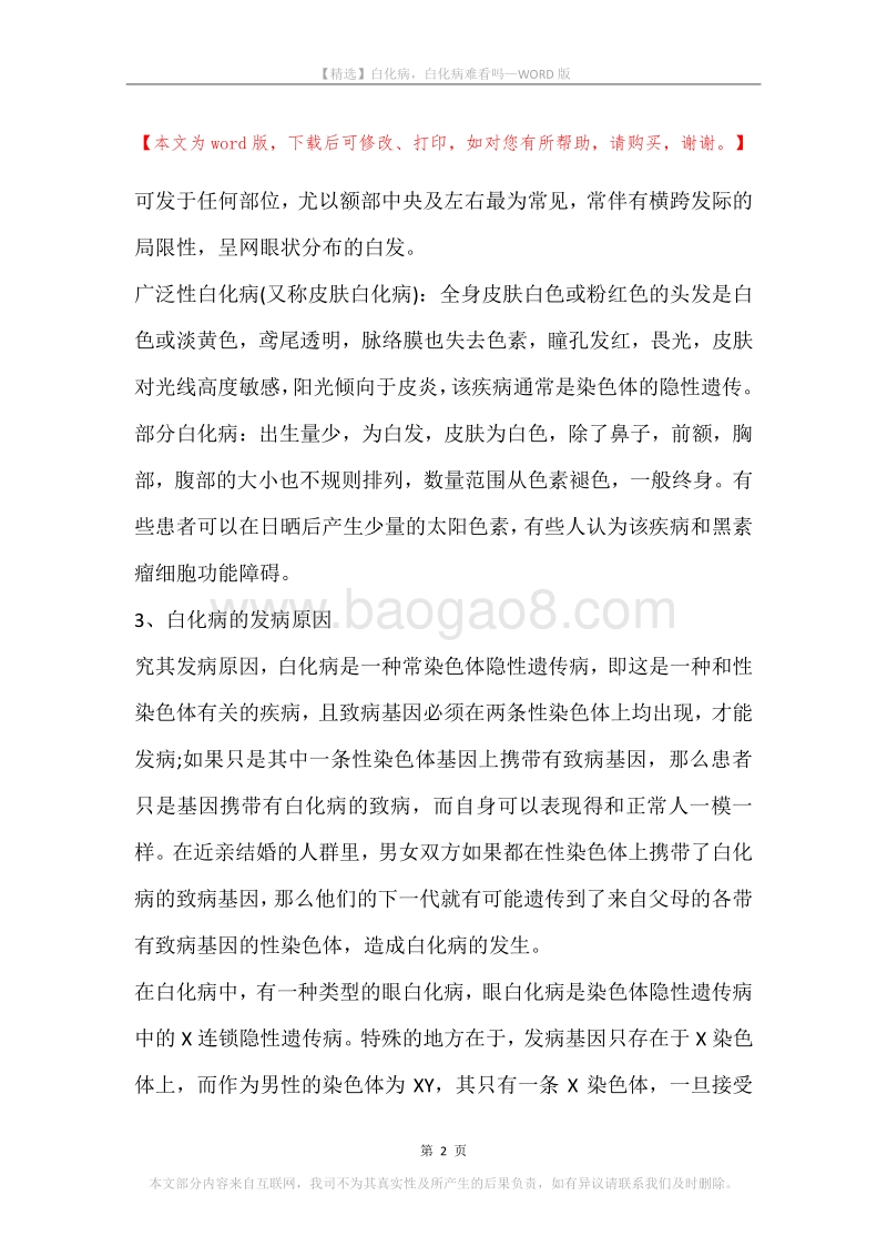 白化病，白化病难看吗.docx_第2页