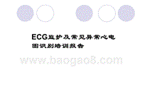 ECG监护及常见异常心电图识别培训报告.ppt
