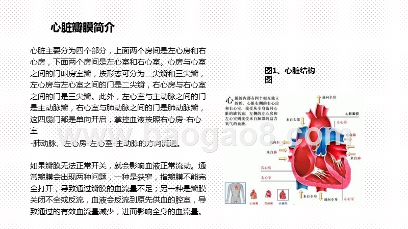 2020心脏瓣膜市场发展现状及前景研究报告.pptx_第3页