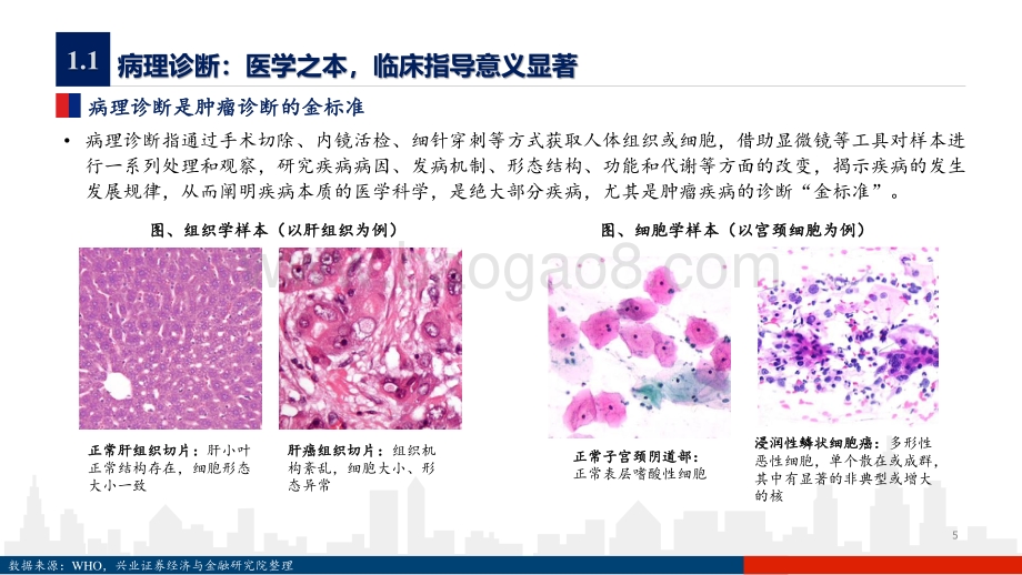 病理诊断行业深度报告：追本溯源长期被忽略的“医学之本”.pdf_第5页