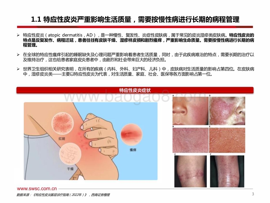 20240126_西南证券_医药行业：特应性皮炎药物国产替代将至_50页.pdf_第4页
